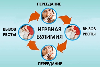 Лечение булимии в Калаче-на-Дону